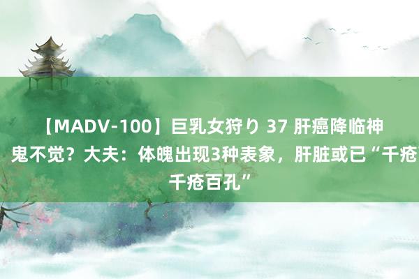 【MADV-100】巨乳女狩り 37 肝癌降临神不知，鬼不觉？大夫：体魄出现3种表象，肝脏或已“千疮百孔”